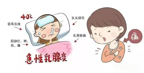 回奶乳腺炎，怎么办？