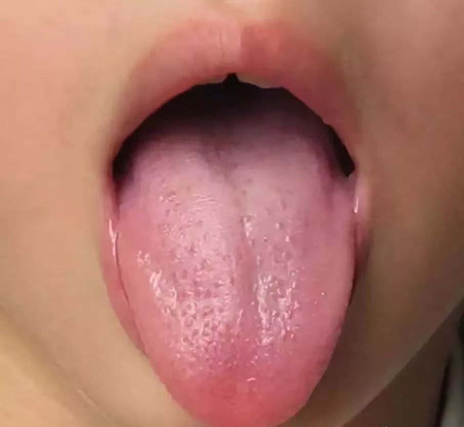 过度喂养危害大，宝宝发出的积食信号你能看懂多少？