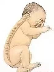 【母婴知识】“头”等大事，新生儿枕头使用须知！